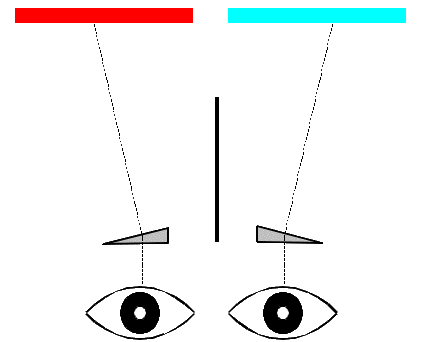 Estereoscopio de Holmes